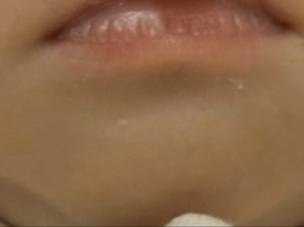 「取りたい取りたい取りたい…」母が投稿→赤ちゃんの口あるあるに4万いいね「わかります」「私は取った」