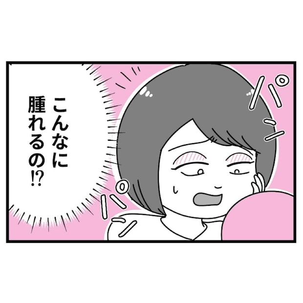 手術台で涙→二重まぶたに整形した直後に「うそ…」予想以上の事態に｜初めての彼氏に裏切られて整形した話