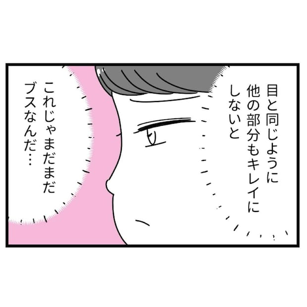 「まだブス」二重まぶたを手に入れた女性→さらなる違和感に気づく|初めての彼氏に裏切られて整形した話