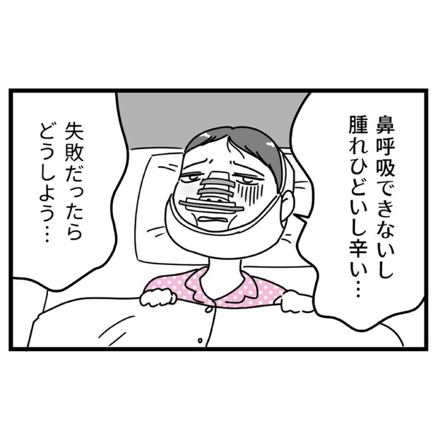 過酷なダウンタイム乗り越え→整形で得た【自分を愛せる】という喜び｜初めての彼氏に裏切られて整形した話