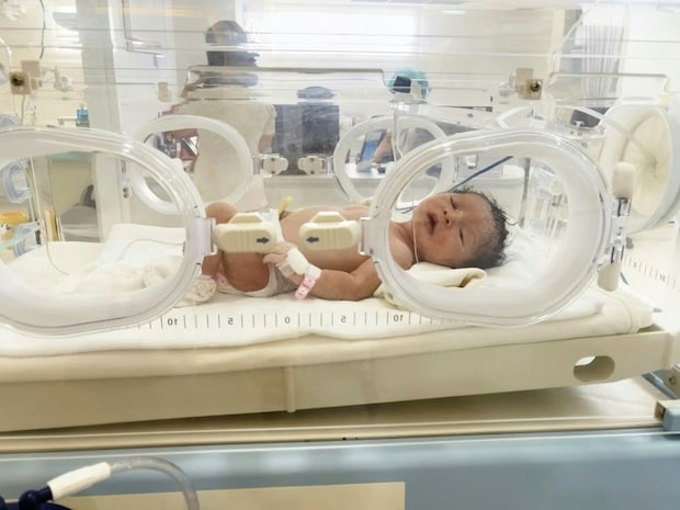 NICUで医師と看護師が「ばんざーい!」→奇跡の瞬間に3.3万いいね「涙が出る」「感謝しかない」
