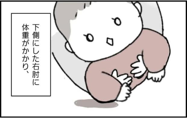 寝返りしたわが子の腕から「ポキッ…」→直後に火がついたように泣き叫んだ【恐ろしい状況】