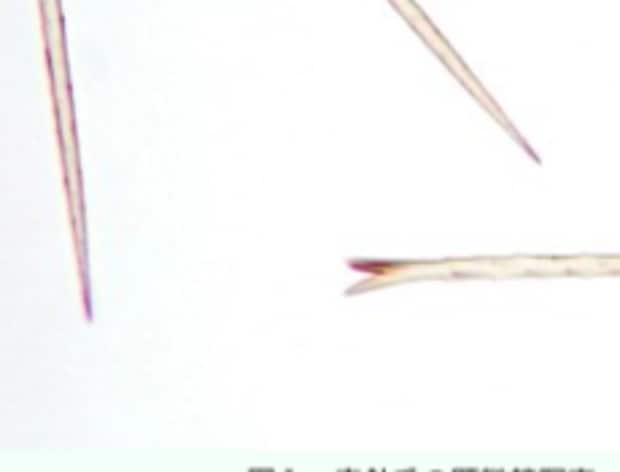 【謎のブツブツに要注意】毛虫被害の注意喚起に1.6万いいね「現場で使える工夫」「大事な注意喚起」