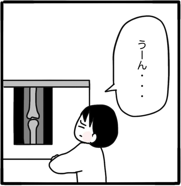 「うーん…」まさかの診断結果。私の足の異変、原因は何なの？｜家族がバラバラになったのは誰のせい？