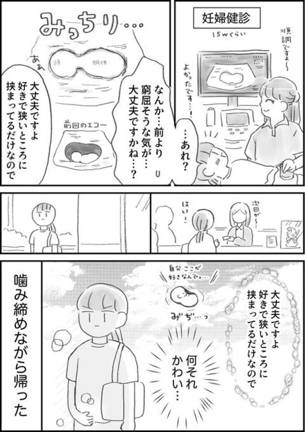 エコーを見て窮屈そうな赤ちゃんが心配に→医師の言葉に4,300いいね「かわいすぎる…」「私も前回そうだった」