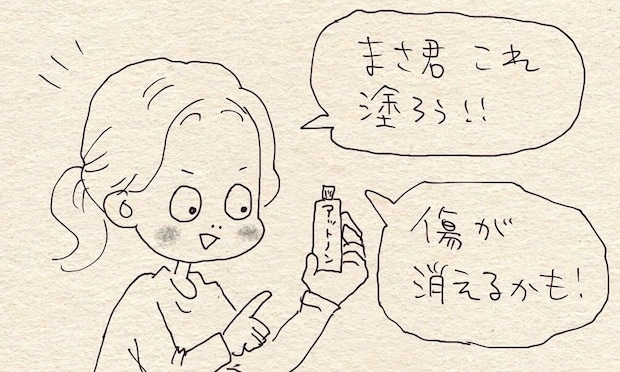 「消したくない…」顔のキズを治したくないわが子。その理由に親がハッとした、愛おしい理由
