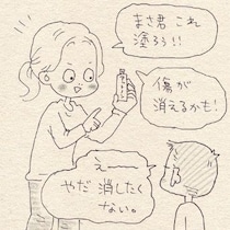 「消したくない…」顔のキズを治したくないわが子。その理由に親がハッとした、愛おしい理由